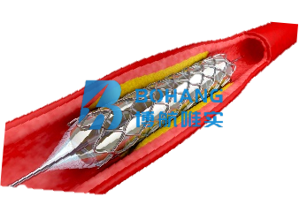 Zinc alloy vascular stent